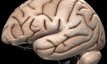 Brain[1]_tiny_landscape